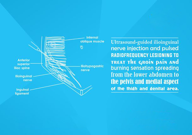 abdomen-pelvic-pain image