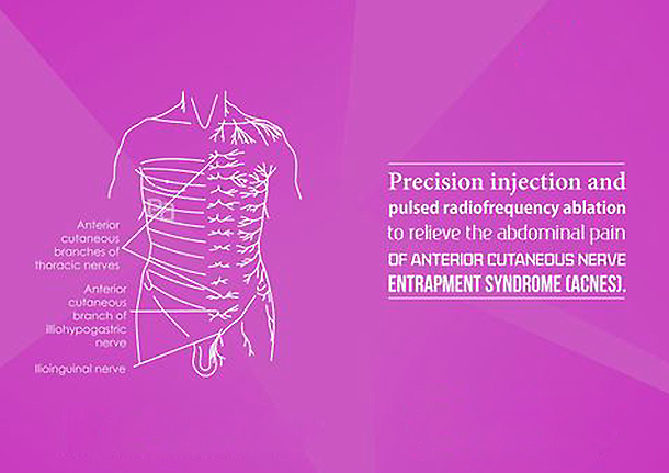 abdomen-pelvic-pain image