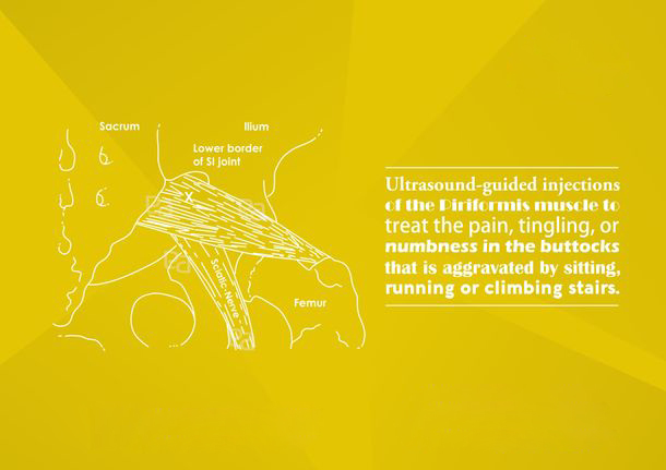abdomen-pelvic-pain image