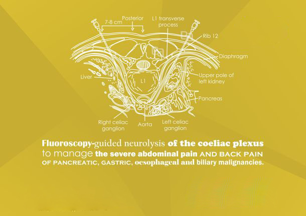 abdomen-pelvic-pain image