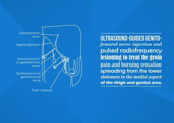 abdomen-pelvic-pain image