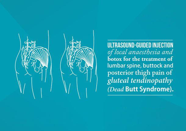 abdomen-pelvic-pain image