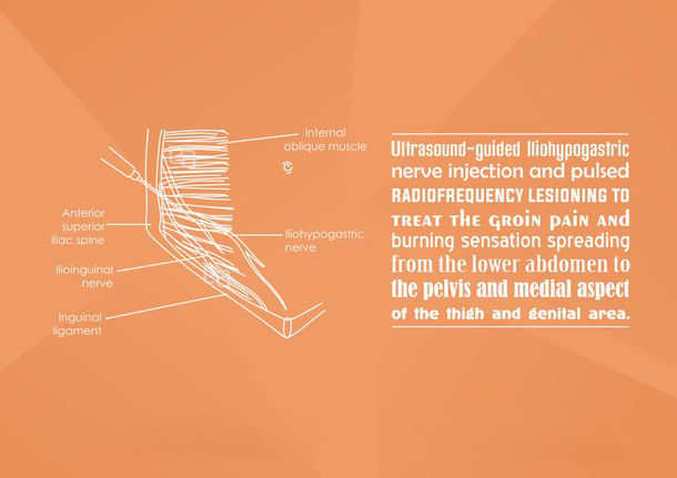 abdomen-pelvic-pain image