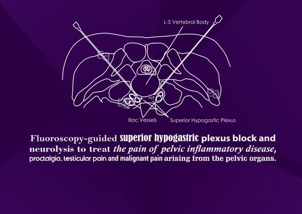 abdomen-pelvic-pain image