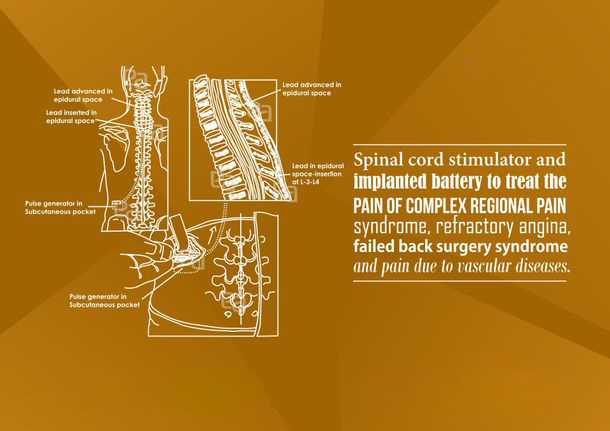 advanced-procedures images