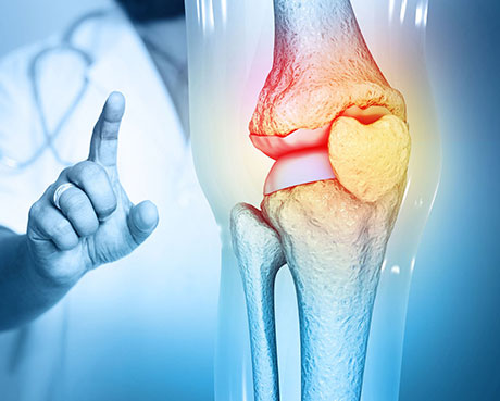 PRP treatment image - Atlas